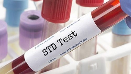STD Testing Service