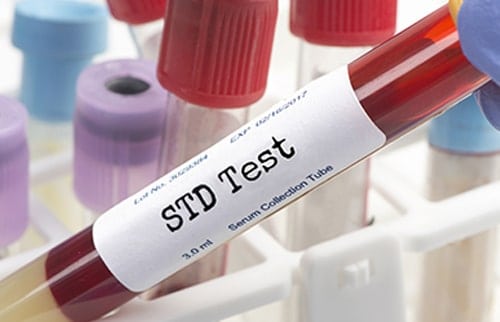 std test