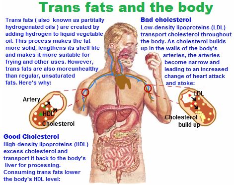    อันตรายจากไขมันทรานส์