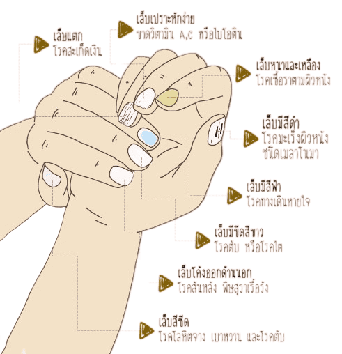 ต่อไปนี้คือลักษณะของเล็บที่อาจบ่งบอกภาวะสุขภาพของท่าน