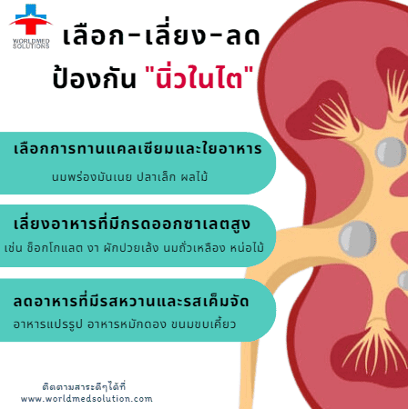 ป้องกันนิ่วในไต เลือก เลี่ยง ลด